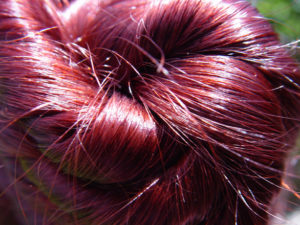 Hair transplant in Hungary